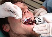 What is a CEREC Crown? Roseville, CA
