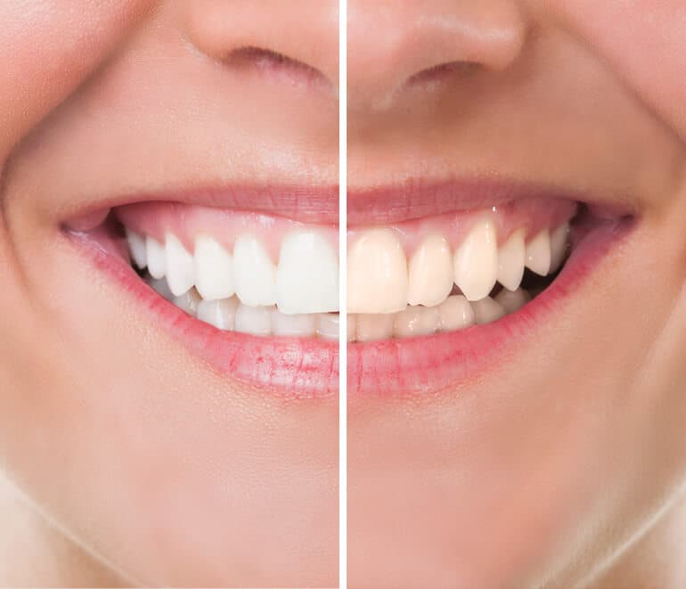 Full Month Reconstruction